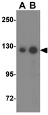 Anti-AP3B2 antibody used in Western Blot (WB). GTX17145