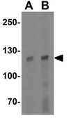 Anti-ANKLE2 antibody used in Western Blot (WB). GTX17159