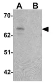 Anti-ZGPAT antibody used in Western Blot (WB). GTX17161