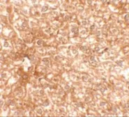 Anti-Epac2 antibody used in IHC (Paraffin sections) (IHC-P). GTX17165