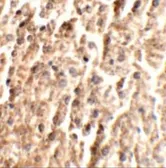 Anti-Angiopoietin 2 antibody used in IHC (Paraffin sections) (IHC-P). GTX17167