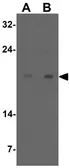 Anti-SDHAF1 antibody used in Western Blot (WB). GTX17172