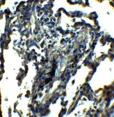Anti-NDFIP1 antibody used in IHC (Paraffin sections) (IHC-P). GTX17176