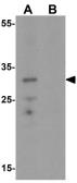 Anti-C/EBP delta antibody used in Western Blot (WB). GTX17179