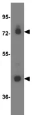 Anti-ACSL1 antibody used in Western Blot (WB). GTX17180