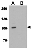 Anti-Cyclin T1 antibody used in Western Blot (WB). GTX17200