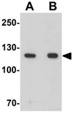 Anti-PHC3 antibody used in Western Blot (WB). GTX17211