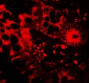 Anti-APOBEC3B antibody used in IHC (Paraffin sections) (IHC-P). GTX17214