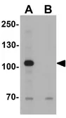 Anti-USP25 antibody used in Western Blot (WB). GTX17216