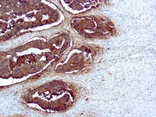 Anti-CEA antibody [Col-1] (ready-to-use) used in IHC (Paraffin sections) (IHC-P). GTX17238