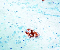 Anti-Alpha fetoprotein / AFP antibody [C3] used in IHC (Paraffin sections) (IHC-P). GTX17240