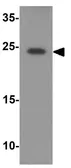 Anti-ARHI antibody used in Western Blot (WB). GTX17241