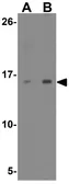 Anti-Relaxin 3 antibody used in Western Blot (WB). GTX17243