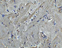 Anti-PACS2 antibody used in IHC (Paraffin sections) (IHC-P). GTX17244