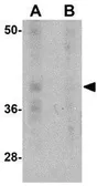 Anti-PD1 antibody [7A11B1] used in Western Blot (WB). GTX17271
