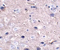 Anti-PD1 antibody [12A7D7] used in IHC (Paraffin sections) (IHC-P). GTX17273