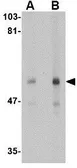 Anti-CD4 antibody [9H5A8] used in Western Blot (WB). GTX17277