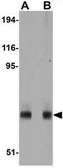 Anti-IRAK1 antibody [8F1A7] used in Western Blot (WB). GTX17299