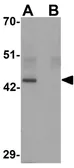 Anti-KLF4 antibody [4E5C3] used in Western Blot (WB). GTX17306