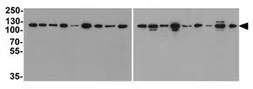 Anti-Vinculin antibody [7E10] used in Western Blot (WB). GTX17308