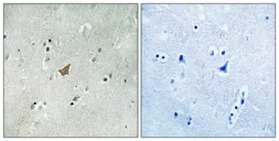 Anti-EphA3 (phospho Tyr779) / EphA4 (phospho Tyr779) / EphA5 (phospho Tyr833) antibody used in IHC (Paraffin sections) (IHC-P). GTX17348