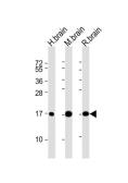 Anti-LC3A antibody [166AT1234] used in Western Blot (WB). GTX17380