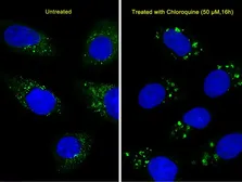 Anti-LC3A antibody [166AT1234] used in Immunocytochemistry/ Immunofluorescence (ICC/IF). GTX17380