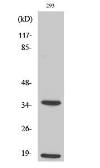 Anti-Caspase 6 (cleaved Asp179) antibody used in Western Blot (WB). GTX17383