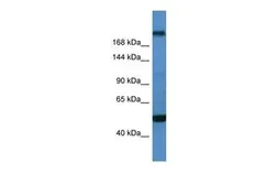 Anti-TCF20 antibody, C-term used in Western Blot (WB). GTX17396