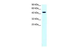 Anti-SLC17A2 antibody, Internal used in Western Blot (WB). GTX17427