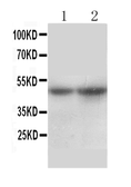 Anti-NTCP antibody used in Western Blot (WB). GTX17430