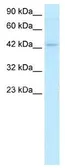 Anti-LEF1 antibody used in Western Blot (WB). GTX17431