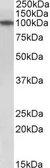 Anti-TXNDC11 antibody used in Western Blot (WB). GTX17445