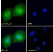 Anti-RBM20 antibody used in Immunocytochemistry/ Immunofluorescence (ICC/IF). GTX17481