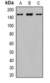 Anti-Gli1 antibody used in Western Blot (WB). GTX17495