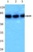Anti-CD39 antibody used in Western Blot (WB). GTX17496