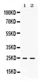 Anti-FGF19 antibody used in Western Blot (WB). GTX17500