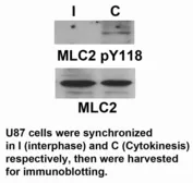 Anti-Myosin Light Chain 2 (MLC-2v) (phospho Tyr118) antibody used in Western Blot (WB). GTX17511