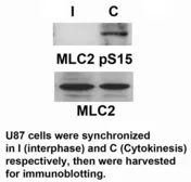 Anti-Myosin Light Chain 2 (MLC-2v) (phospho Ser15) antibody used in Western Blot (WB). GTX17513