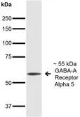 Anti-GABA A Receptor alpha 5 antibody [S415-24] used in Western Blot (WB). GTX17517