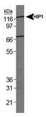 Anti-HIP1R antibody [1E1] used in Western Blot (WB). GTX17528