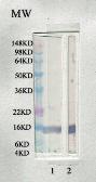 Anti-Leptin antibody used in Western Blot (WB). GTX17531