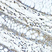 Anti-SIRT1 antibody used in IHC (Paraffin sections) (IHC-P). GTX17532