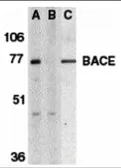 Anti-BACE1 antibody used in Western Blot (WB). GTX17545