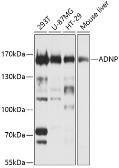 Anti-ADNP antibody used in Western Blot (WB). GTX17559