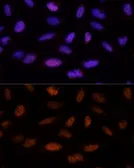 Anti-ADNP antibody used in Immunocytochemistry/ Immunofluorescence (ICC/IF). GTX17559