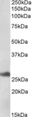 Anti-DNAJB9 antibody used in Western Blot (WB). GTX17566