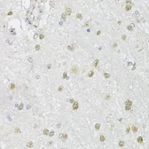 Anti-CMAS antibody used in IHC (Paraffin sections) (IHC-P). GTX17569