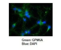 Anti-GPM6A antibody used in Immunocytochemistry/ Immunofluorescence (ICC/IF). GTX17572