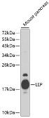 Anti-Leptin antibody used in Western Blot (WB). GTX17573